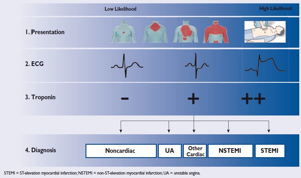 La prise en charge du syndrome coronarien aigu Sans sus décalage du segment ST à la lumière des recommandations