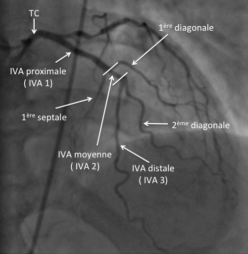 Circulation coronaire et microcirculation myocardique