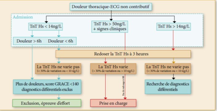 TR2